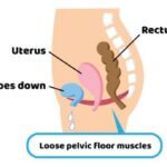 les exercices de Kegel