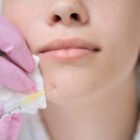 LE MICROTOX ET LE MAXIMALISME : LA TENDANCE DES CHERRY LIPS 🔥