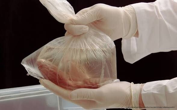 LE TRAFIC D’ORGANES : UNE INDUSTRIE CRIMINELLE AU CŒUR DE LA VIE HUMAINE