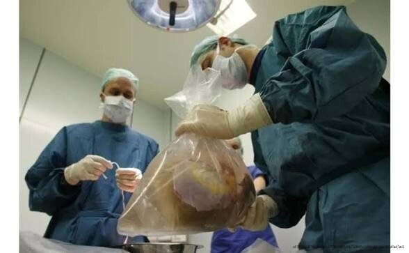 LE TRAFIC D'ORGANES : UNE INDUSTRIE CRIMINELLE AU CŒUR DE LA VIE HUMAINE 6 Vers une prise de conscience
