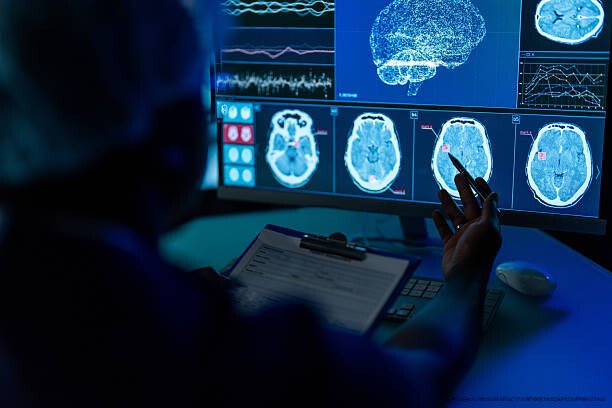 L'ÉMERGENCE DE CAPACITÉS EXTRAORDINAIRES APRÈS UN ACCIDENT CÉRÉBRALE 4 L'impact sociétal des histoires de réussite