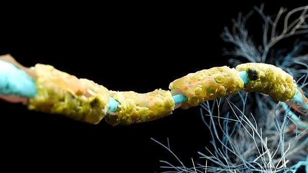 LA NEUROPLASTICITÉ : UNE RÉVOLUTION DANS LA COMPRÉHENSION DU CERVEAU 5 Neuroplasticité et santé mentale